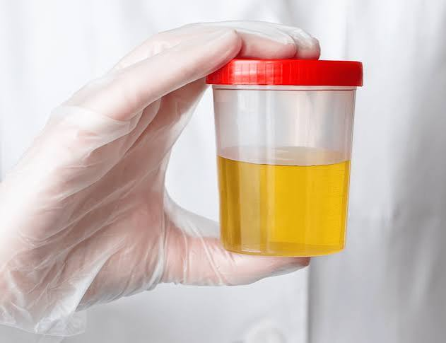 Analisi urine