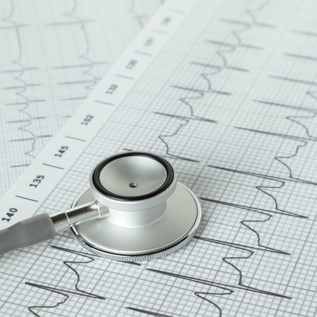 ECG