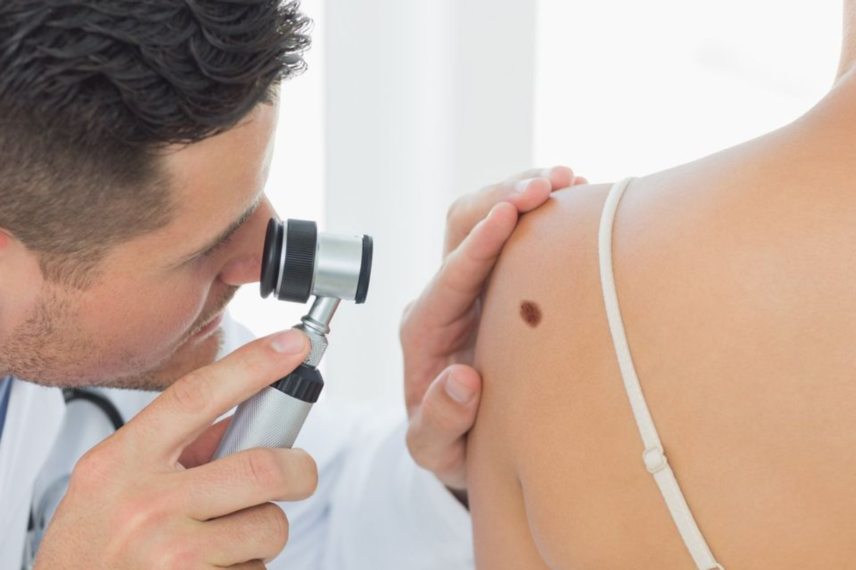 Teledermatologia